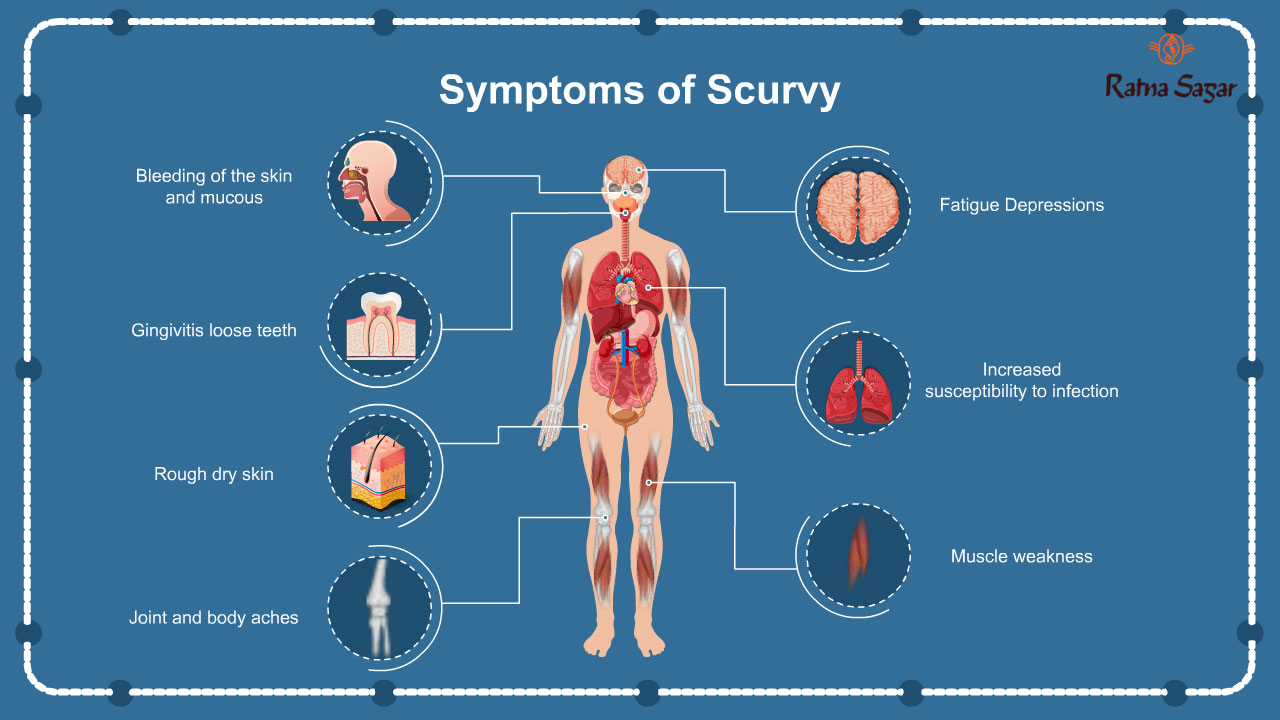 infographic image