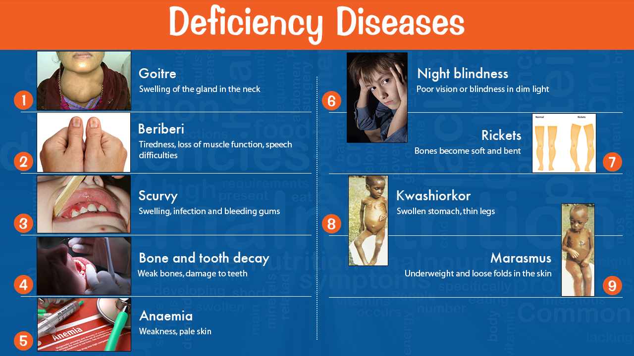 infographic image